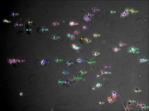 Cells are detected and tracked using time-lapse microscopy images.