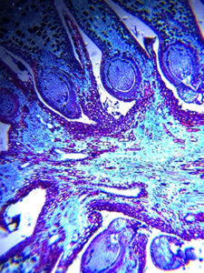 Smartphone image of a pine cone ovulate as seen through Daniel Miller's DIY microscope.