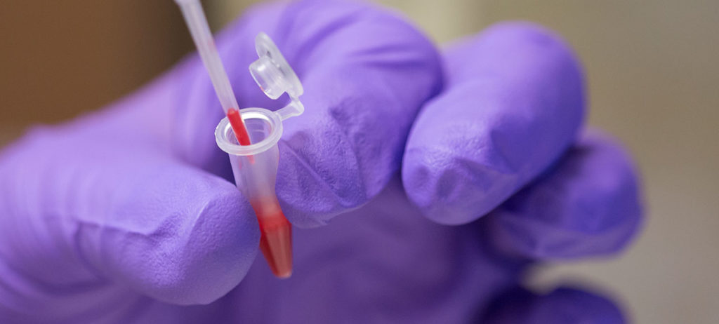 Elizabeth Bowles, a Ph.D. student in chemistry, extracts a blood sample while working on her research in Schrenk Hall.
