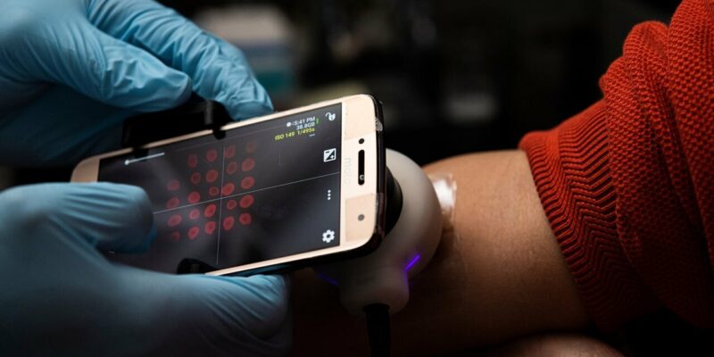 Biomedical engineers develop ‘smart’ sensor bandages